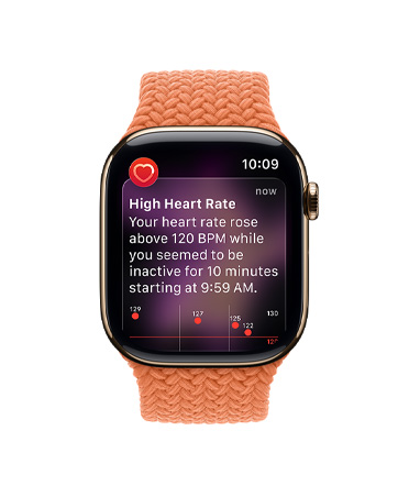 Apple Watch Series 11, kućište od titanija zlatne boje, obavijest o visokom pusu, pletena narukvica Solo, boja kurkuma