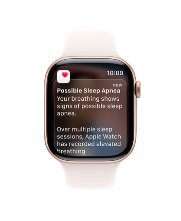 Apple Watch Series 11, ružičasto zlatna boja, aluminijsko kućište, proširena obavijest o apneji u snu, vanjska desna strana, Digital Crown, sportski remen, rumena boja